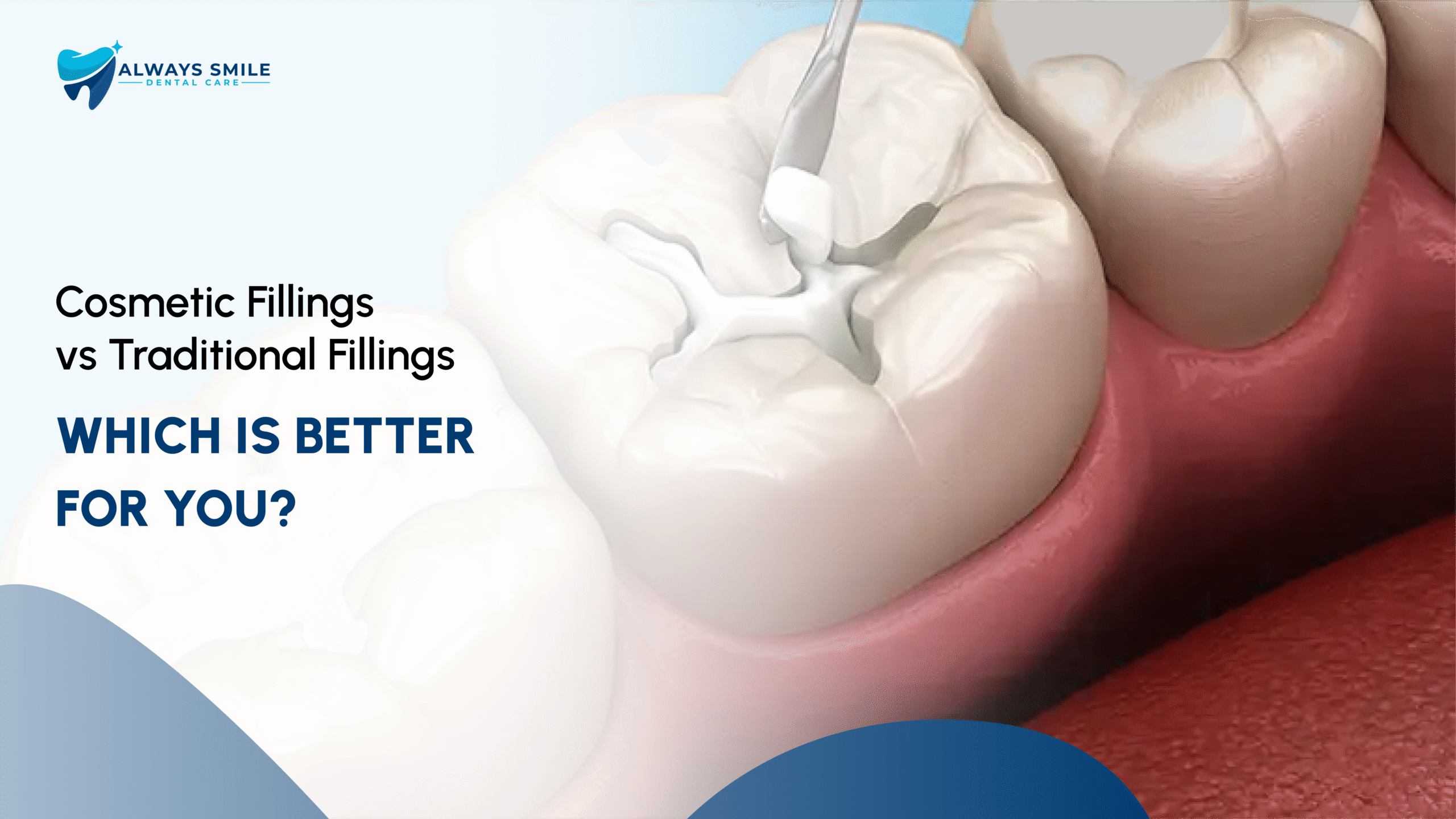 Root Canal vs Tooth Extraction: Best Option in North Brunswick