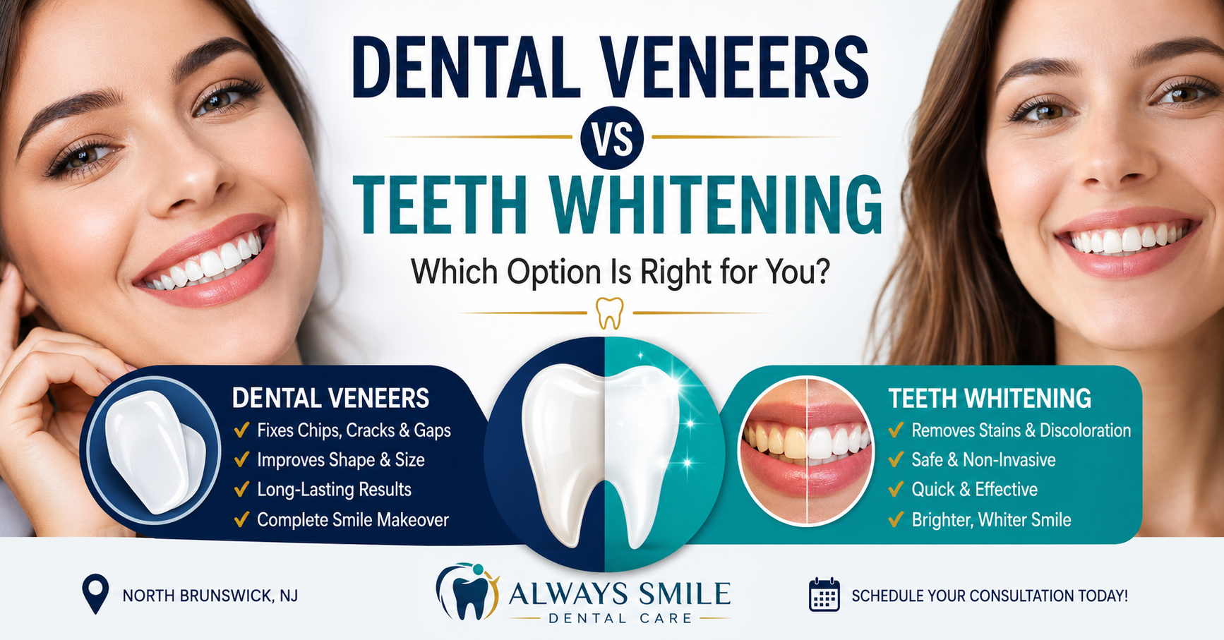 Dental Veneers vs Teeth Whitening: Which Option Is Right for You?
