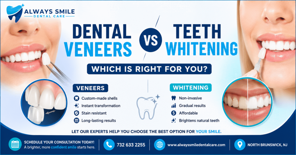 Comparison of dental veneers and teeth whitening treatments at Always Smile Dental Care in North Brunswick for achieving a brighter, more confident smile.